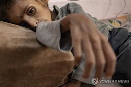 "가자 급성 영양실조 아동 3배 급증…이스라엘 봉쇄 여파"