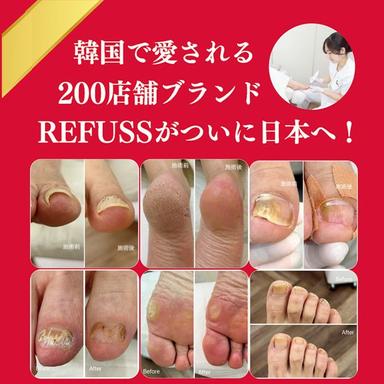 REFUSS